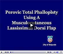 FtM SRS Gender Reassignment Surgery: Surgical Phalloplasty Video