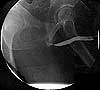 diagnostic medical imaging