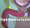 Ligamentolysis surgery cuts the ligament holding the penis inside the body so it extends more outside the body